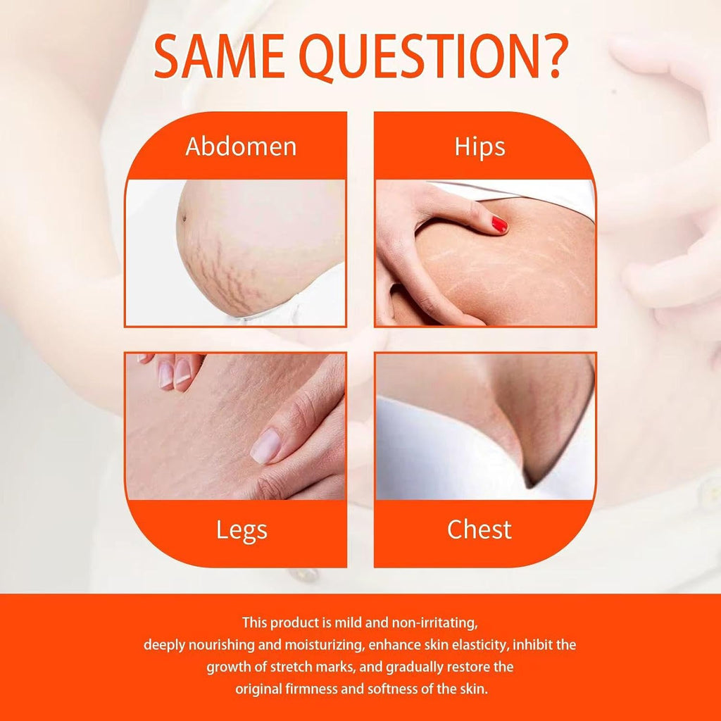 Stretch Marks and Scars Removal Cream for Pregnancy - Scars Repair, Abdominal Firming, and Gentle Stretch Marks Eradication Skincare Body