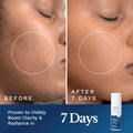 Clear Out Skin Clarifying Cream
